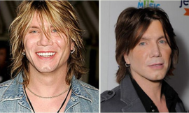 Unraveling the Mystery of Johnny Rzeznik’s Plastic Surgery