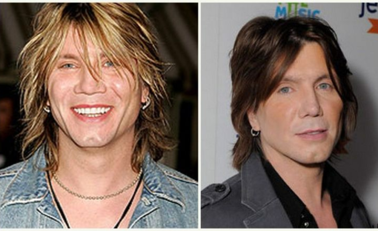 Read more about the article Unraveling the Mystery of Johnny Rzeznik’s Plastic Surgery